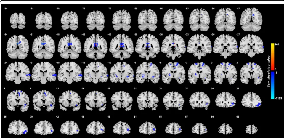 Fig. 4 Voxels in the brain with different functional connectivity in the comparison medicated–the absolute values of thenon-medicated patients with depression
