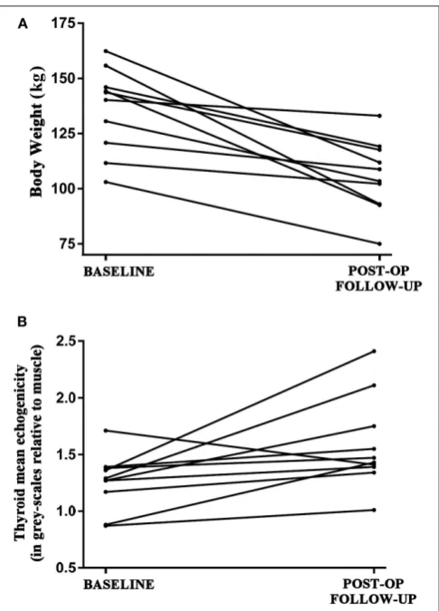 FIGURE 1 | (A) Decrease in the absolute body weight (kg) of theeuthyroid study patients (n = 10) between the baseline (pre- bariatric surgery)and follow-up (post bariatric surgery; after achieving at least 5% weight loss;mean duration between visits 16.5 ± 2.5 months) assessments.(B) Respective increase in the echogenicity of the thyroid parenchyma in thestudy patients between the baseline and post-surgery follow-up assessments,as expressed in gray-scales relative to the muscle echogenicity from theperformed ultrasound scanning gray-scale histogram analysis.