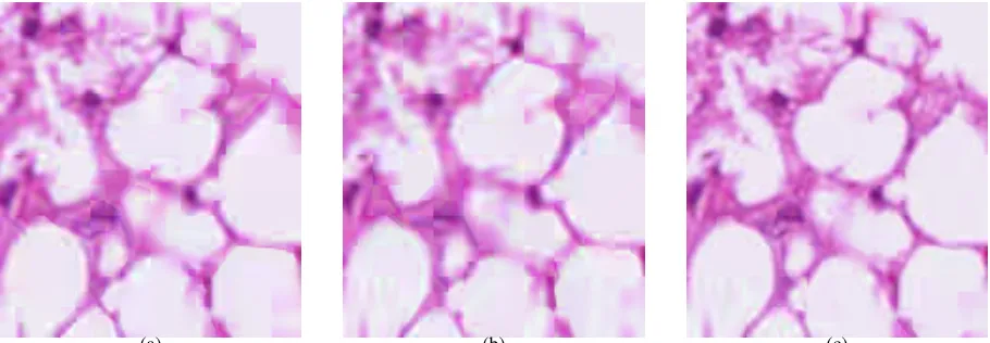 Fig. 7: Reconstructed non-RoI section of test image LYMP2 encoded at 0.133 bpppc using (a) approach 1, (b) approach 3,and (c) the proposed graph-based RC algorithm.