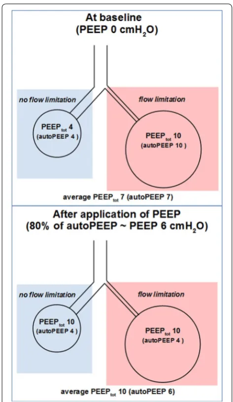 Fig. 2 Effect of PEEP on areas with and without flow limitation. In the non-flow-limited areas, and the overall observed response to PEEP is intermediate between them