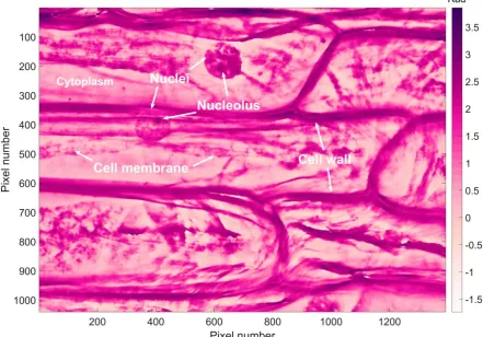 Figure 4.14 Quantitative phase image of epidermis cells of Allium cepa using 6+F@60°PSA from LCA based LQPIM system