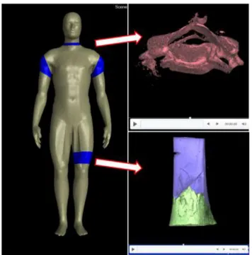Figure 9: Presentation as shown in court. The dummy model contained hyperlinks which led to animations of the individual dismemberment locations