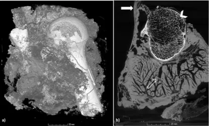 Figure 5: a) Volume rendered image of the charred lump recovered from the oil drum. b) Vertical slice through the lump, displaying different materials; solid arrow indicates plastic sheets, open arrow indicates undamaged soft tissue from where the DNA samp
