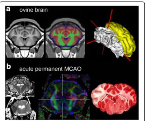 Fig. 1 Focal ischaemic lesions in ovine brain.decreased diffusion in apparent diffusion coefficient maps ofdiffusion weighted imaging (DWI-ADC,anisotropy map of diffusion tensor imaging (DTI-FA,reveals a loss of fibre integrity