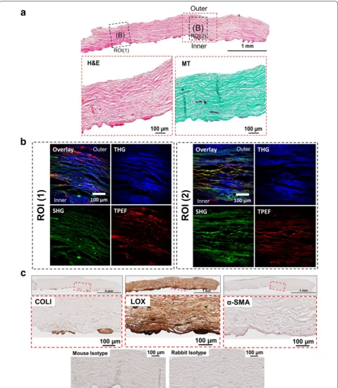 Fig. 1 Histological and NLO microscopy images of capsule with Baker grade 3 (example 1)
