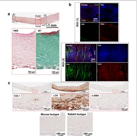 Fig. 3 Histological and NLO microscopy images of capsule with Baker grade 4 (example 1)