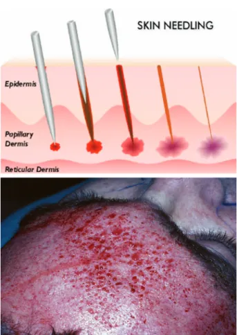 Fig. 2. The operative procedure.