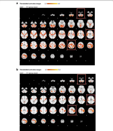 Figure 2 Whole brain statistical analysis of the BOLD activity at a group level during the motor task is shown for 10 healthy subjects at the first(a) and the second (b) session