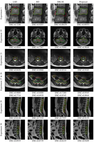 Fig. 8. Visual results attained by LSD, RD, DRLSE and our proposed method, for Part 2 experiments