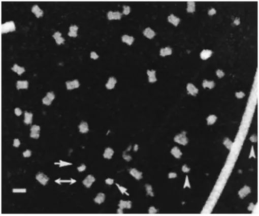 Fig. 2. Methylamine vana- vana-date–stained STEM  imag-es of pIV. A sample of pIV was applied to a grid to which TMV had already been added and washed as described in Fig