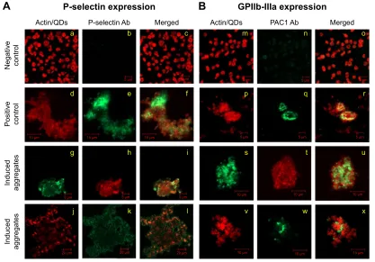 Figure 2 Analysis of effect of CdTe QDs on platelet receptors by fluorescent microscopy.Notes: expression of P-selectin (A) or gPIIb-IIIa (B) receptors was analyzed in negatively charged 2.6 nm (g, h, i, s, t, u) or 4.8 nm (j, k, l, v, w, x) cdTe QD-induce