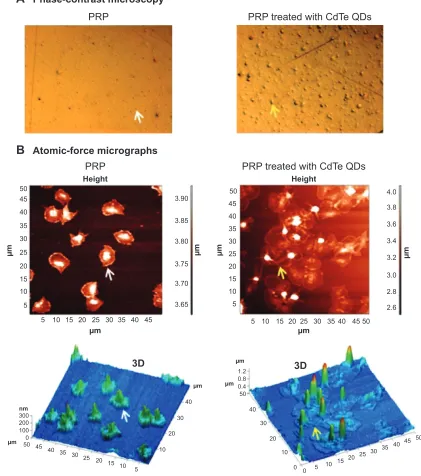 Figure 6 Phase-contrast and atomic-force micrographs of cdTe QD-induced platelet microaggregates on QcM-D crystals.Notes: after measuring the frequency and dissipation, the quartz crystals with adhered platelet microaggregates were subjected to phase-contr