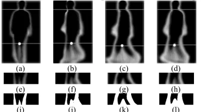 Fig. 7. Segmentation of sub-level set parts using GEnIs: (a)-(d) GEnIs in 18°, 
