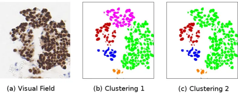 Figure 7. An example of two potential nuclei clusterings. Figure 7a shows the original image, Fig. 7b shows one potential clustering of the detected nuclei, Fig. 7c shows a different potential clustering of the detected nuclei.