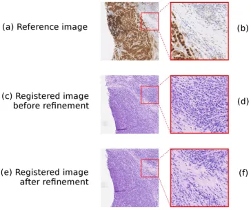 Figure 3. A demonstration of the registration algorithm’s refinement process. Figure 3a shows a visual field from the reference image, with a close-up of part of this region shown in Fig. 3b