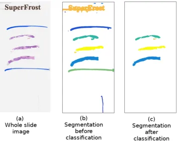 Figure 6. An example of the results of tissue segmentation on a region containing artefacts