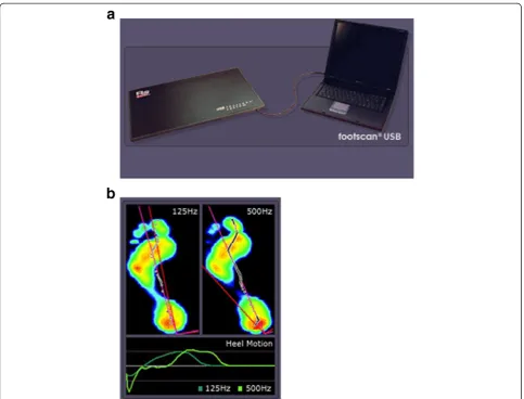 Figure 2 Recording on the force plate.