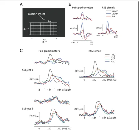 Fig. 1 Magnetic responses in representative subjects. a Stimulus. b magnetic waveforms in pair gradiometers with the greatest response, androot mean square (RSS) signals of pair gradiometers in a representative subject