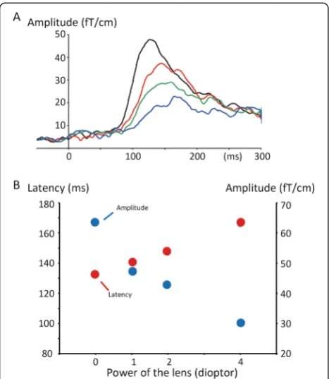 Fig. 2 Effects of refractive errors on M100. a Grand-averaged RSSwaveforms. b The peak latency and amplitude of M100 as a functionof the power of lens