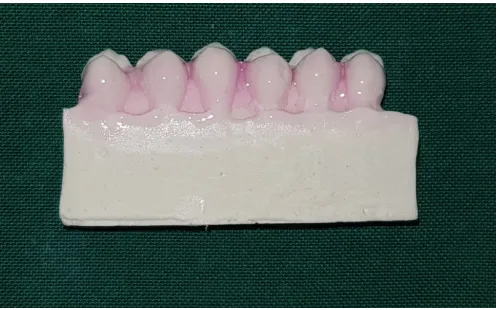 Fig 20. (a) A subgroup consisting of 6 teeth embedded in acrylic block; (b) Impression 