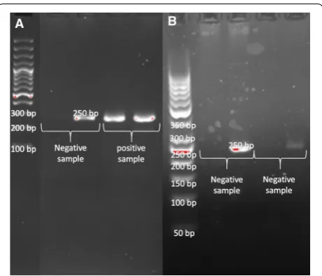 Fig. 2 ARMS PCR method (a) a negative and heterozygote positive sample, mutant forward primer and wild type forward primer (b) negative samples, mutant forward primer had not been amplified and wild type forward primer have been amplified