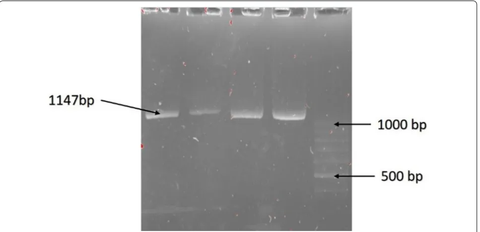 Fig. 4 Digested amplified with BsaXI in polyacrylamide gel stained by silver. It shows 950 bp, 807 bp, 140 bp and 130 bp in heterozygote positive rows also 807 bp, 140 bp and 130 bp in negative rows