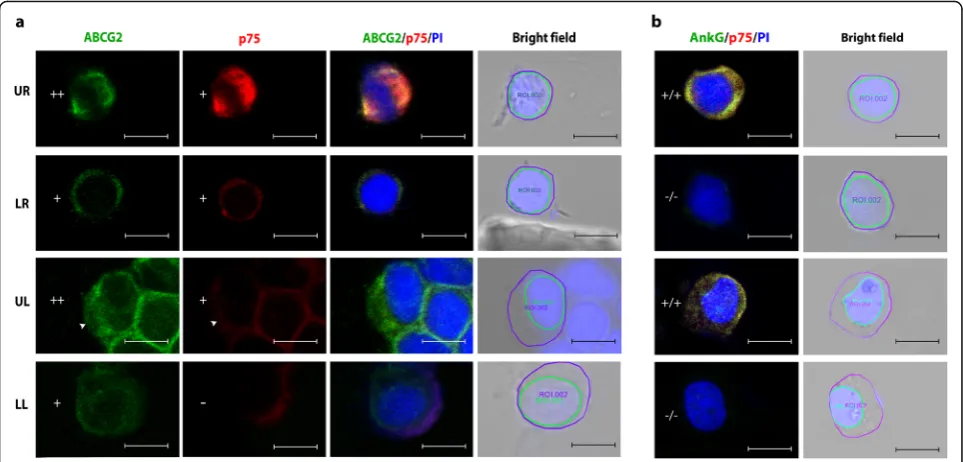 Fig. 4 Representative confocal images of TM double immunostained for ABCG2 (FITC-green), p75 (Alexa 633- red) and overlay of ABCG2 and p75expression with nuclear counterstain PI (blue)