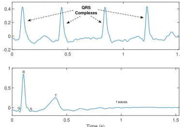 Fig. 2: Top: a 1.5-second segment of an AF ECG recording (in mV) with 4 QRS complexes from one patient (P2)