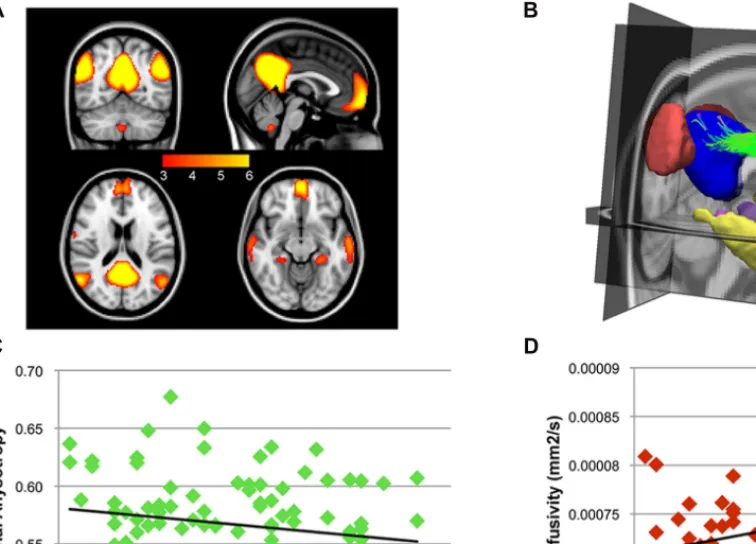 FIGURE 3 | After the group ICA, BrainCAT correctly identified the DMN. (A) The DMN clusters that survived the peak threshold of Z > 3.09