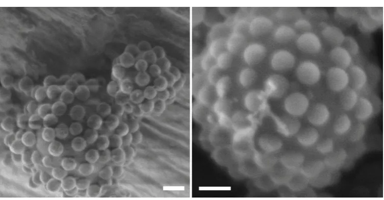 Figure 2.12 Cryo-SEM images of polymersomes armoured with PS particles with a 