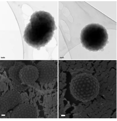 Figure 2.15 Cryo-TEM (top two) and Cryo-SEM (bottom two) images of 