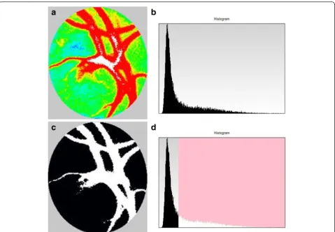 Fig. 3 Composite maps and histograms at the optic nerve head (ONH) created by laser speckle flowgraphy