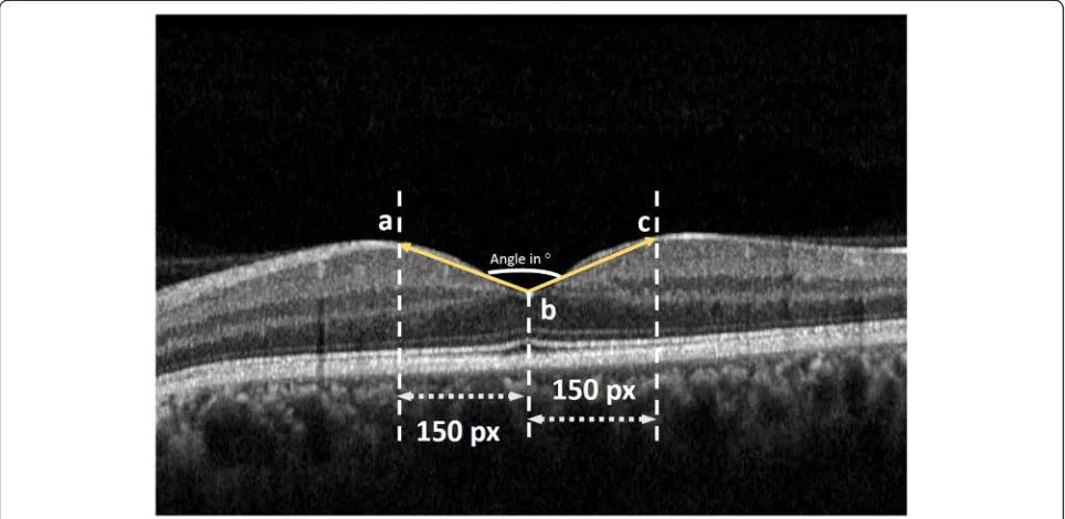 Fig. 2 Image demonstrating the technique for foveal angle measurement using Image J