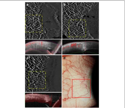 Fig. 1 Examples of corneal limbal AS-OCTA scans in a normal healthy eye. We used three different AS-OCTA systems:source OCTA system,imaged with slit-lamp photography ( a PLEX Elite 9000 swept- b AngioVue RTVue XR Avanti OCTA system, and c Angioscan RS-3000