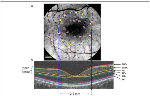 Fig. 2 Retinal blood flow and tissue volume of the inner retina.6 × 6 mmdots) were summed to obtain the total arteriolar flow of the macula