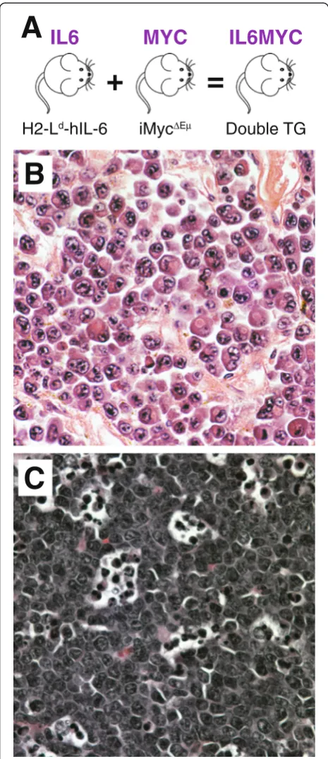 Figure 1 MYC and/or IL-6 driven mouse models of human Burkittlymphoma (BL) and multiple myeloma (MM)