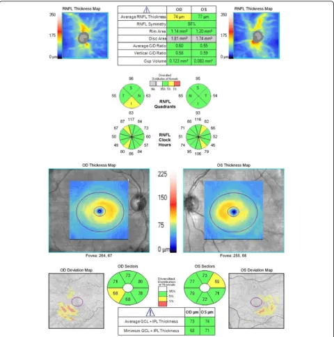 Fig. 4 Cirrus OCT report of a 70-year old patient suspected of having glaucoma in both eyes