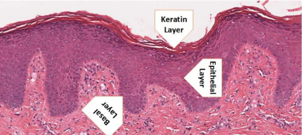 Figure 1. A patch of WSI showing layers of the oral epithelium. Top/most superficial layer- keratin layer, middle- epithelial layer and bottom- basal layer with underlying connective tissue