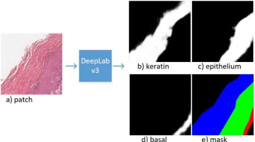 Figure 2. The prediction of the network (i.e., DeepLab v3)a) on input patch extracted from the tissue section of WSI and b, c, d) the prediction of layers into keratin, epithelium and basal separately