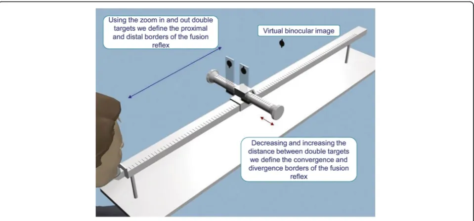 Fig. 3 Calculation of the Binocularity Field Area