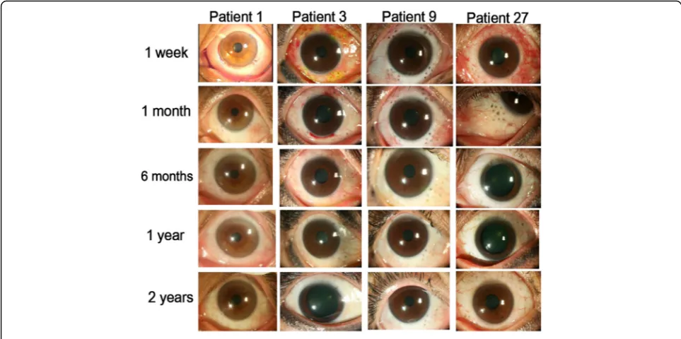 Fig. 8 Serial photographs of representative patients from postoperative 1 week to 2 years