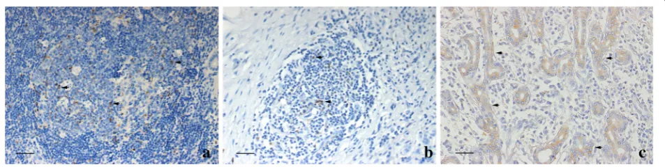 Fig. 4 The grade 3 lymphoid neogenesis displayed a typical segregation of T and B cells in GC-like structures.respectively
