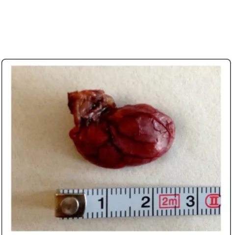 Figure 3 Example of a laparoscopic caecum resection in an animal from Group 2. Initially the caecum and the terminal ileum were inspected.(A) Avascular plane between both structures (white star)