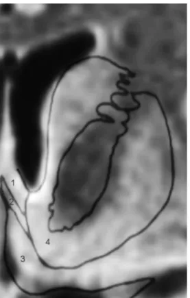 Figure 3.2 Structures within the basal forebrain: (1) septum; (2) diagonal band of Brocca; (3) subcallosal area; (4) nucleus accumbens