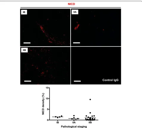 Figure 2 Expression of activated Notch1 in different stages of osteosarcoma. The panels show representative images of Notch intracellulardomain (NICD; red) expression in stages IB, IIA and IIB osteosarcoma tissues