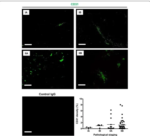 Figure 3 Expression of CD31 in different stages of osteosarcoma. The panels show representative images of CD31 expression (green) fromstages IA to IIB osteosarcoma tissues