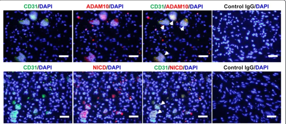 Figure 4 Expression of CD31, cytoplasmic ADAM10 and activated Notch1 in multinucleated giant cells.anti-mouse secondary Ab (green)