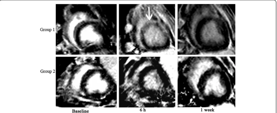 Figure 3 Changes in CeMRI before and after CME in Group 1 and Group 2. Group 1: coronary microembolization with 120,000microspheres