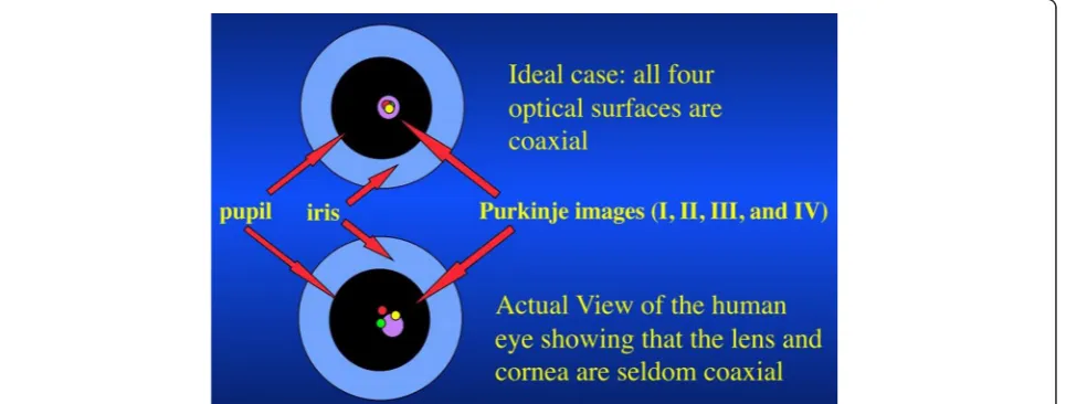 Figure 1 Purkinje images of the human eye compared to an ideal coaxial optical system
