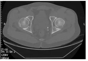 Figure 8: X-ray of the hips and pelvis 